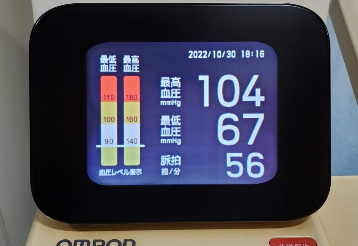 血圧測定　血圧計